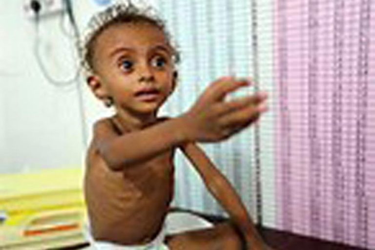 国連、戦争で破壊されたイエメンで飢饉を警告