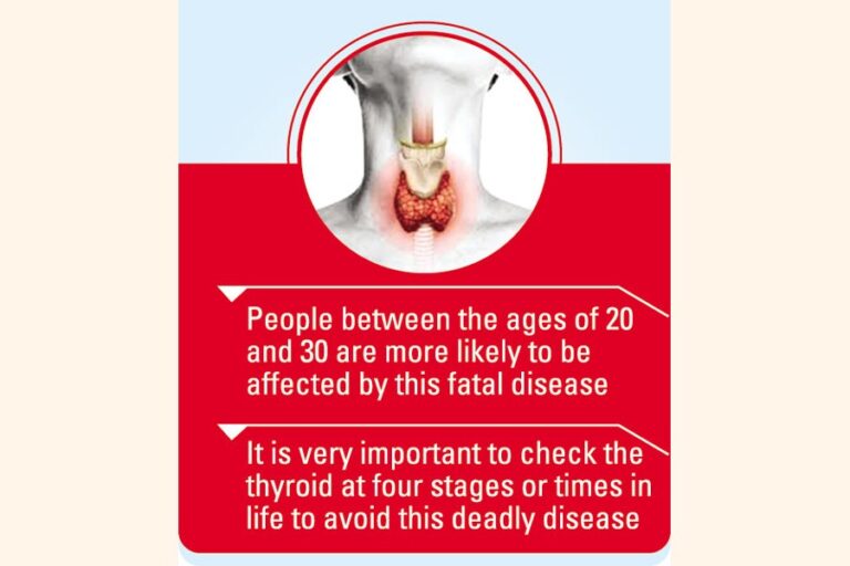 国内の30%の人が甲状腺疾患に苦しんでいる：専門家