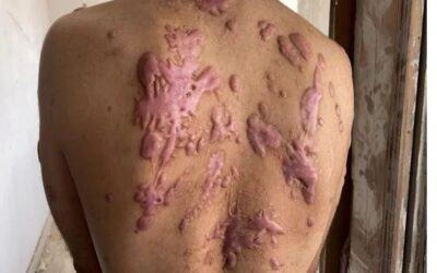 パレスチナ人が火傷、暴行、電気ショックを受ける