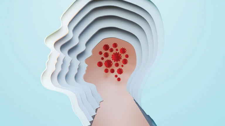 ウイルス感染と認知症：脳を守るためにできること