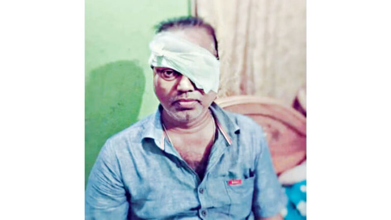 警察の銃撃で視力を失ったサラウディン氏が死去