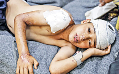 医療制度が崩壊に近づき、ガザ地区の数万人が生涯にわたる障害に直面