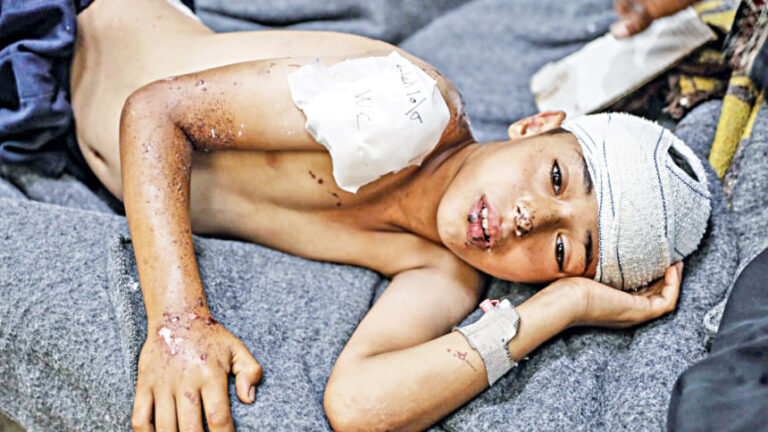 医療制度が崩壊に近づき、ガザ地区の数万人が生涯にわたる障害に直面