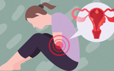 子宮内膜症：世界中で何百万人もの女性が罹患している一般的な病気