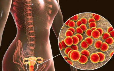 薬剤耐性淋病に対する単回投与薬の有効性