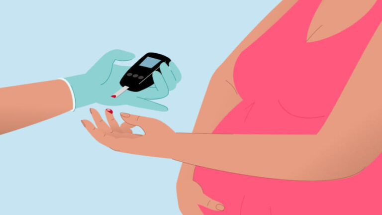 妊娠糖尿病は母親の認知能力の低下と子供の発達リスクの上昇につながる