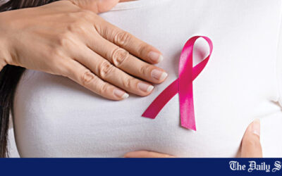 高濃度乳房組織を持つ女性の早期発見の画期的進歩