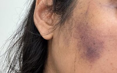 バナスリーで犬に餌をやっていた女性が暴行を受ける