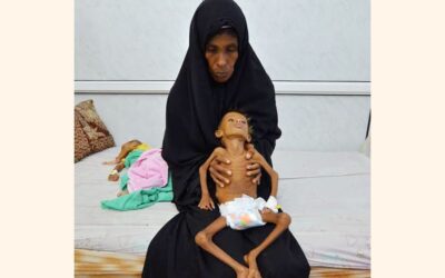 イエメンの飢餓危機は「壊滅的な事態」に発展する可能性がある：国連
